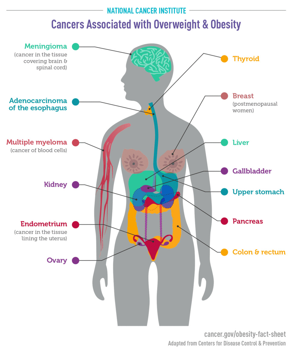 cancers-associated-with-obesity-infographic_970x1174.jpg